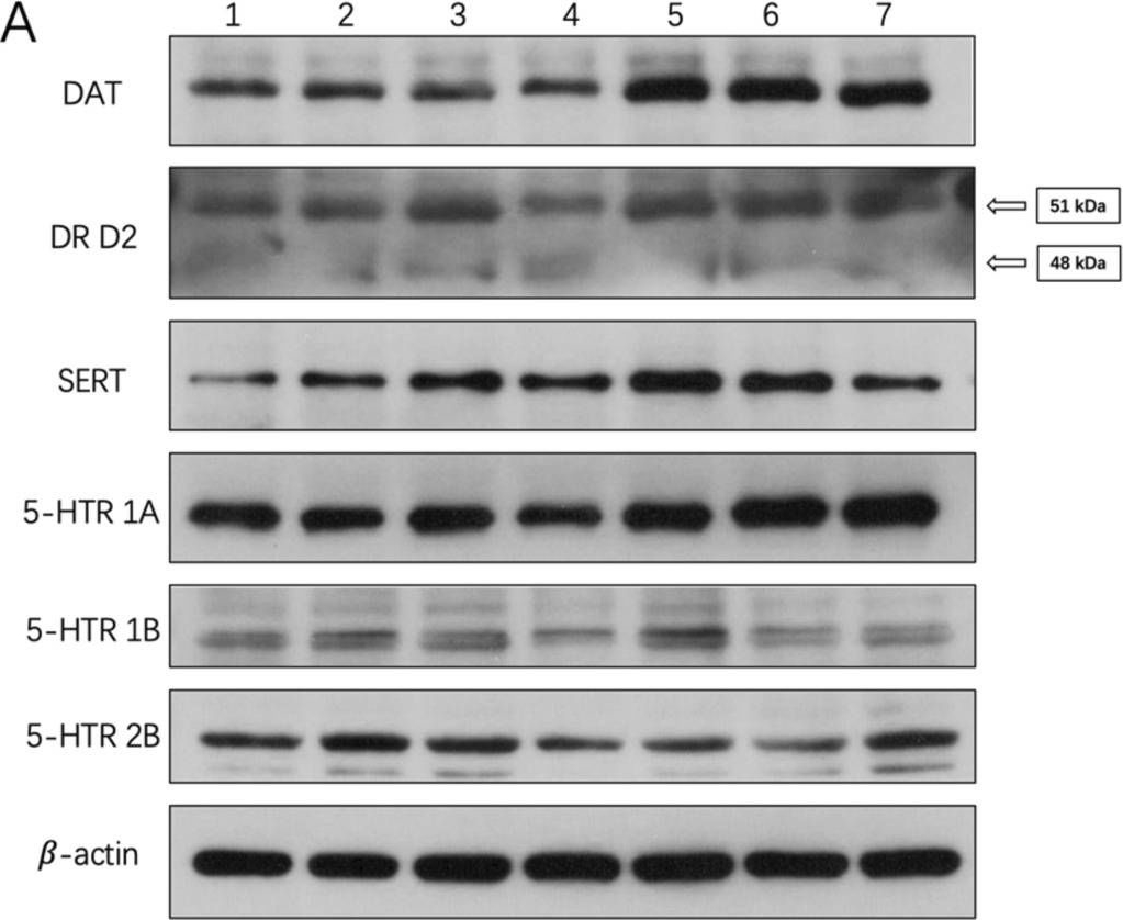 DAT antibodies - Antibody search engine - CiteAb