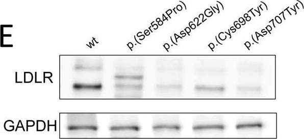 Mutation type classification and pathogenicity assignment of sixteen missense variants located in the EGF-precursor homology domain of the LDLR.