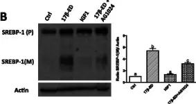 Fig.7.B showing Western Blotting from the publication: 17β-estradiol induces stearoyl-CoA desaturase-1 expression in estrogen receptor-positive breast cancer cells.