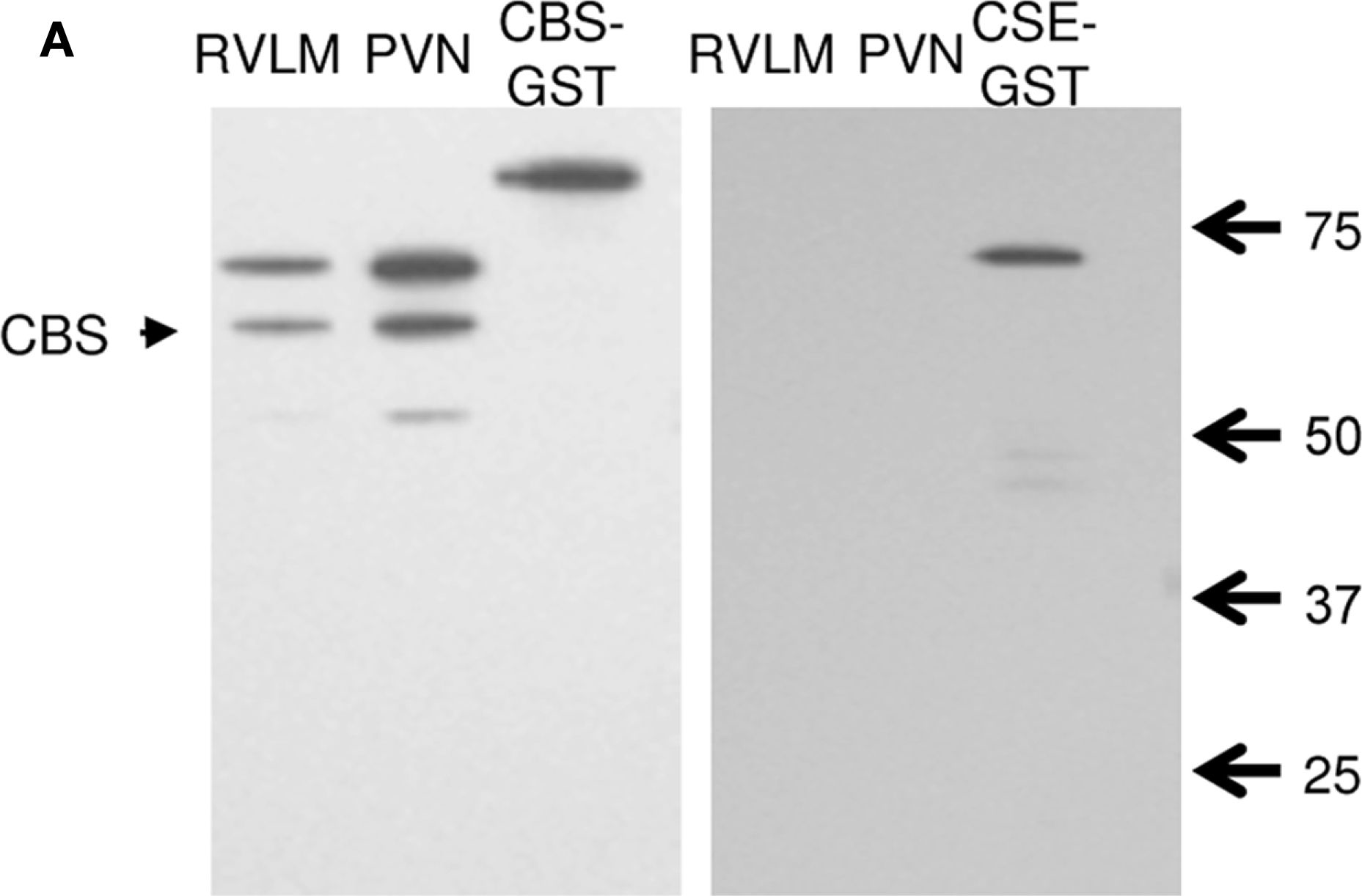 Fig.1.A showing Western Blotting in a Rattus norvegicus (Rat) sample from the publication: Hydrogen Sulfide in the RVLM and PVN has No Effect on Cardiovascular Regulation.