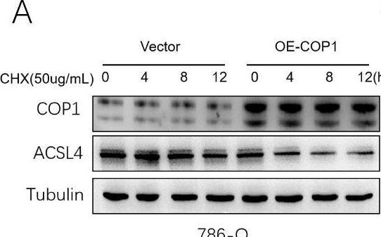 Fig.3.A showing Western Blotting in a Homo sapiens (Human) sample from the publication: COP1 drives renal cell carcinoma progression by targeting ACSL4 for ubiquitin-mediated degradation and inhibiting ferroptosis.