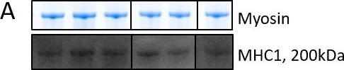 Fig.6.A showing Western Blotting in a Mus musculus (House mouse) sample from the publication: Benefits of Prenatal Taurine Supplementation in Preventing the Onset of Acute Damage in the Mdx Mouse.