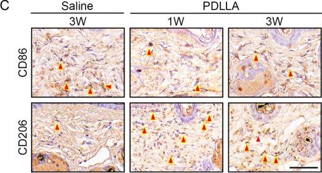 Fig.3.C showing Immunohistochemistry in a Mus musculus (House mouse) sample from the publication: Poly-D,L-Lactic Acid Filler Increases Hair Growth by Modulating Hair Follicular Stem Cells in Aged Skin.