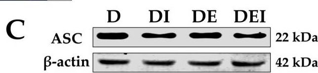 Fig.4.C showing Western Blotting in a Mus musculus (House mouse) sample from the publication: MCC950 Ameliorates Diabetic Muscle Atrophy in Mice by Inhibition of Pyroptosis and Its Synergistic Effect with Aerobic Exercise.
