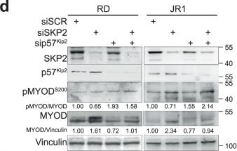 Fig.5.D showing Western Blotting from the publication: MYOD-SKP2 axis boosts tumorigenesis in fusion negative rhabdomyosarcoma by preventing differentiation through p57Kip2 targeting.
