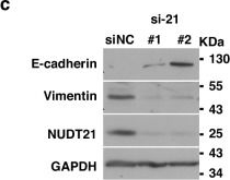 Fig.4.C showing Western Blotting in a Homo sapiens (Human) sample from the publication: Targeting NUDT21-mediated alternative polyadenylation of oncogenes ameliorates colorectal cancer malignancy and metastasis.