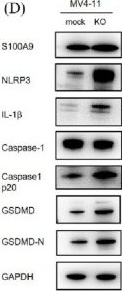 Fig.4.D showing Western Blotting in a Homo sapiens (Human) sample from the publication: Targeting the HERV-K102 envelope elicits pyroptosis and represents a novel therapeutic strategy for acute myeloid leukemia.