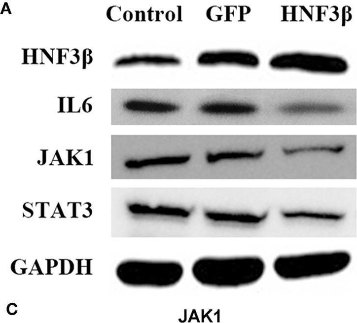 Fig.4.A showing Western Blotting in a Homo sapiens (Human) sample from the publication: Hepatocyte Nuclear Factor 3β Plays a Suppressive Role in Colorectal Cancer Progression.