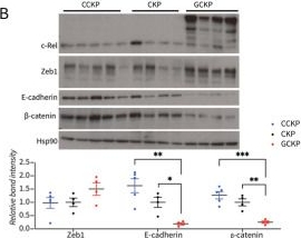 Fig.2.B showing Western Blotting from the publication: c-Rel drives pancreatic cancer metastasis through fibronectin-integrin signaling-induced isolation stress resistance and EMT.