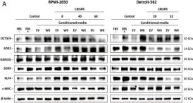 c-Myc (D84C12) Rabbit Monoclonal Antibody | Cell Signaling Technology