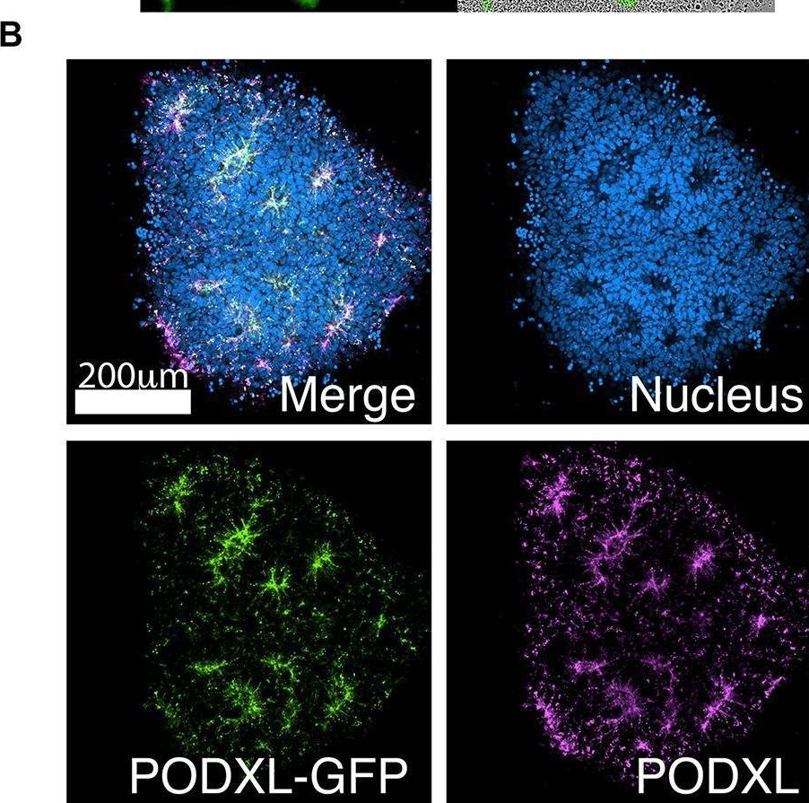 Fig.3.B showing Immunocytochemistry-immunofluorescence from the publication: Effect of Cell Spreading on Rosette Formation by Human Pluripotent Stem Cell-Derived Neural Progenitor Cells.