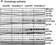 Fig.6.A showing Western Blotting in a Mus musculus (House mouse) sample from the publication: Impairment of autophagy after spinal cord injury potentiates neuroinflammation and motor function deficit in mice.
