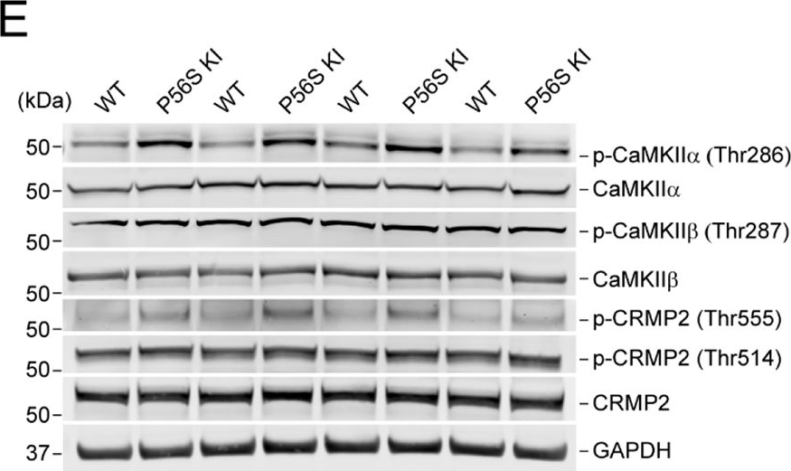 Fig.5.E showing Western Blotting in a Mus musculus (House mouse) sample from the publication: Pathogenic mechanisms of amyotrophic lateral sclerosis-linked VAPB P56S mutation in the degeneration of corticospinal motor neurons.