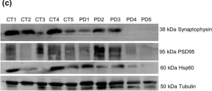 Fig.5.C showing Western Blotting from the publication: Differential protein expression in diverse brain areas of Parkinson's and Alzheimer's disease patients.