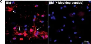 Fig.2.C showing Immunohistochemistry in a Mus musculus (House mouse) sample from the publication: The Bcl-2 Homology-3 Domain (BH3)-Only Proteins, Bid, DP5/Hrk, and BNip3L, Are Upregulated in Reactive Astrocytes of End-Stage Mutant SOD1 Mouse Spinal Cord.