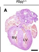 Fig.4.A showing Immunohistochemistry in a Mus musculus (House mouse) sample from the publication: Defective Notch1 signaling in endothelial cells drives pathogenesis in a mouse model of Adams-Oliver syndrome.