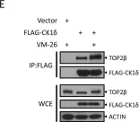 Fig.5.E showing Western Blotting in a Homo sapiens (Human) sample from the publication: SCFβ-TrCP-mediated degradation of TOP2β promotes cancer cell survival in response to chemotherapeutic drugs targeting topoisomerase II.