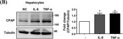 Fig.4.B showing Western Blotting from the publication: CPAP enhances and maintains chronic inflammation in hepatocytes to promote hepatocarcinogenesis.