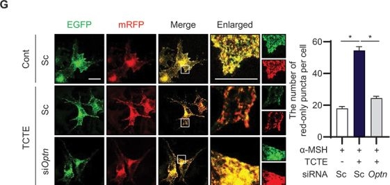 Fig.2.G showing Immunocytochemistry-immunofluorescence in a Mus musculus (House mouse) sample from the publication: Deciphering melanophagy: role of the PTK2-ITCH-MLANA-OPTN cascade on melanophagy in melanocytes.