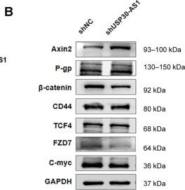 Fig.5.B showing Western Blotting in a Homo sapiens (Human) sample from the publication: USP30-AS1 Dictates Breast Cancer Cell Fate and Chemoresistance via a miR-3646/FZD7/Wnt/β-Catenin Circuit.