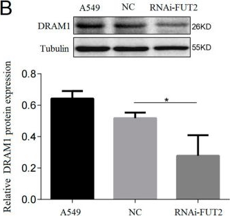 Fig.5.B showing Western Blotting from the publication: FUT2 Facilitates Autophagy and Suppresses Apoptosis via p53 and JNK Signaling in Lung Adenocarcinoma Cells.
