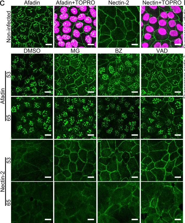 Fig.3.C showing Immunocytochemistry-immunofluorescence from the publication: Distinct strategies of epithelial cell barrier disruption by Leptospira interrogans isolated from human patients in Okinawa, Japan.