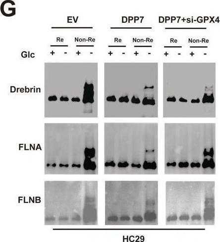 Fig.7.G showing Western Blotting from the publication: DPP7 Promotes Colorectal Cancer Progression Through GPX4-Dependent Suppression of Disulfidptosis and Immune Evasion.