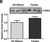 Fig.1.B showing Western Blotting from the publication: CTRP2 overexpression improves insulin and lipid tolerance in diet-induced obese mice.