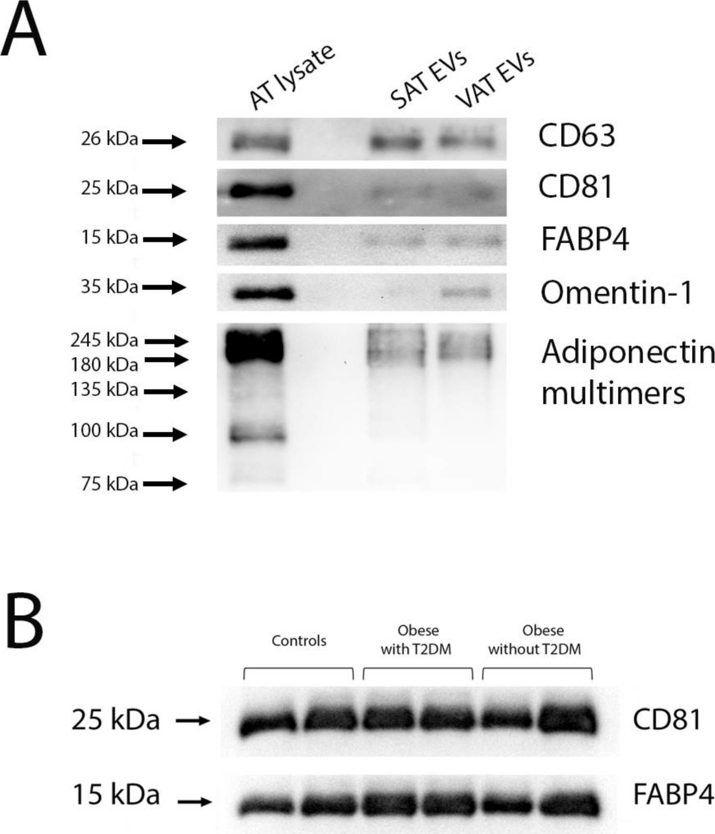 Fig.1.A showing Western Blotting from the publication: Downregulation of Exosomal hsa-miR-551b-3p in Obesity and Its Link to Type 2 Diabetes Mellitus.