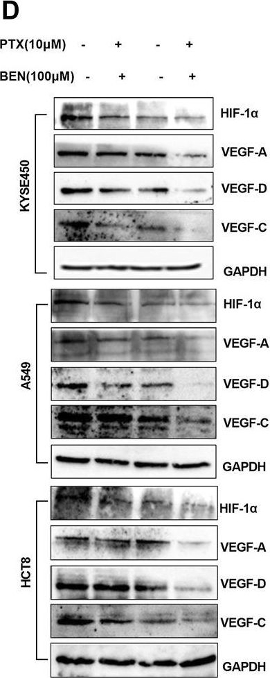Fig.8.D showing Western Blotting from the publication: Benserazide, a cystathionine beta-synthase (CBS) inhibitor, potentially enhances the anticancer effects of paclitaxel via inhibiting the S-sulfhydration of SIRT1 and the HIF1-α/VEGF pathway.