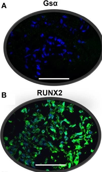 Fig.6.A showing Immunohistochemistry-immunofluorescence in a Homo sapiens (Human) sample from the publication: Targeted silencing of GNAS in a human model of osteoprogenitor cells results in the deregulation of the osteogenic differentiation program.