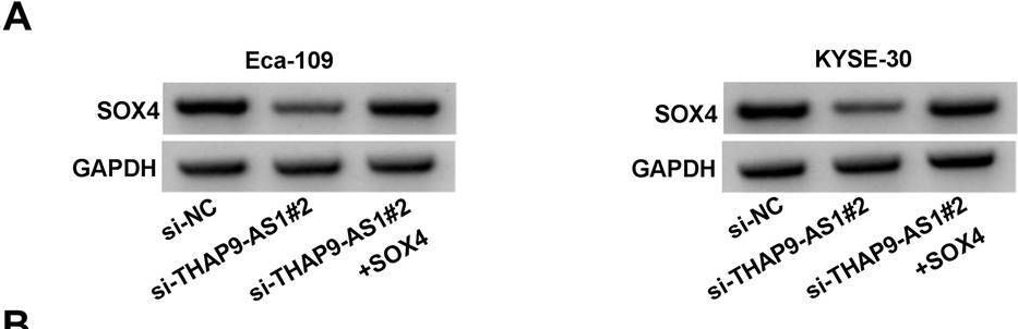 Fig.6.A showing Western Blotting from the publication: THAP9-AS1/miR-133b/SOX4 positive feedback loop facilitates the progression of esophageal squamous cell carcinoma.