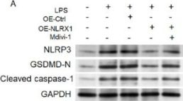 Cleaved Caspase-1 (Asp296) (E2G2I) Rabbit Monoclonal Antibody