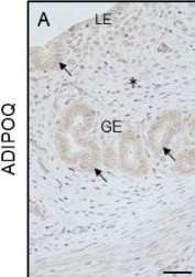 Fig.8.A showing Immunohistochemistry in a Rattus norvegicus (Rat) sample from the publication: Effect of Vitamin D3 on Chemerin and Adiponectin Levels in Uterus of Polycystic Ovary Syndrome Rats.
