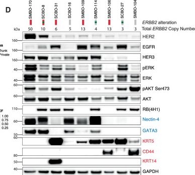 Fig.2.D showing Western Blotting from the publication: Determinants of sensitivity to HER2-targeted antibody drug conjugates in urothelial cancer.