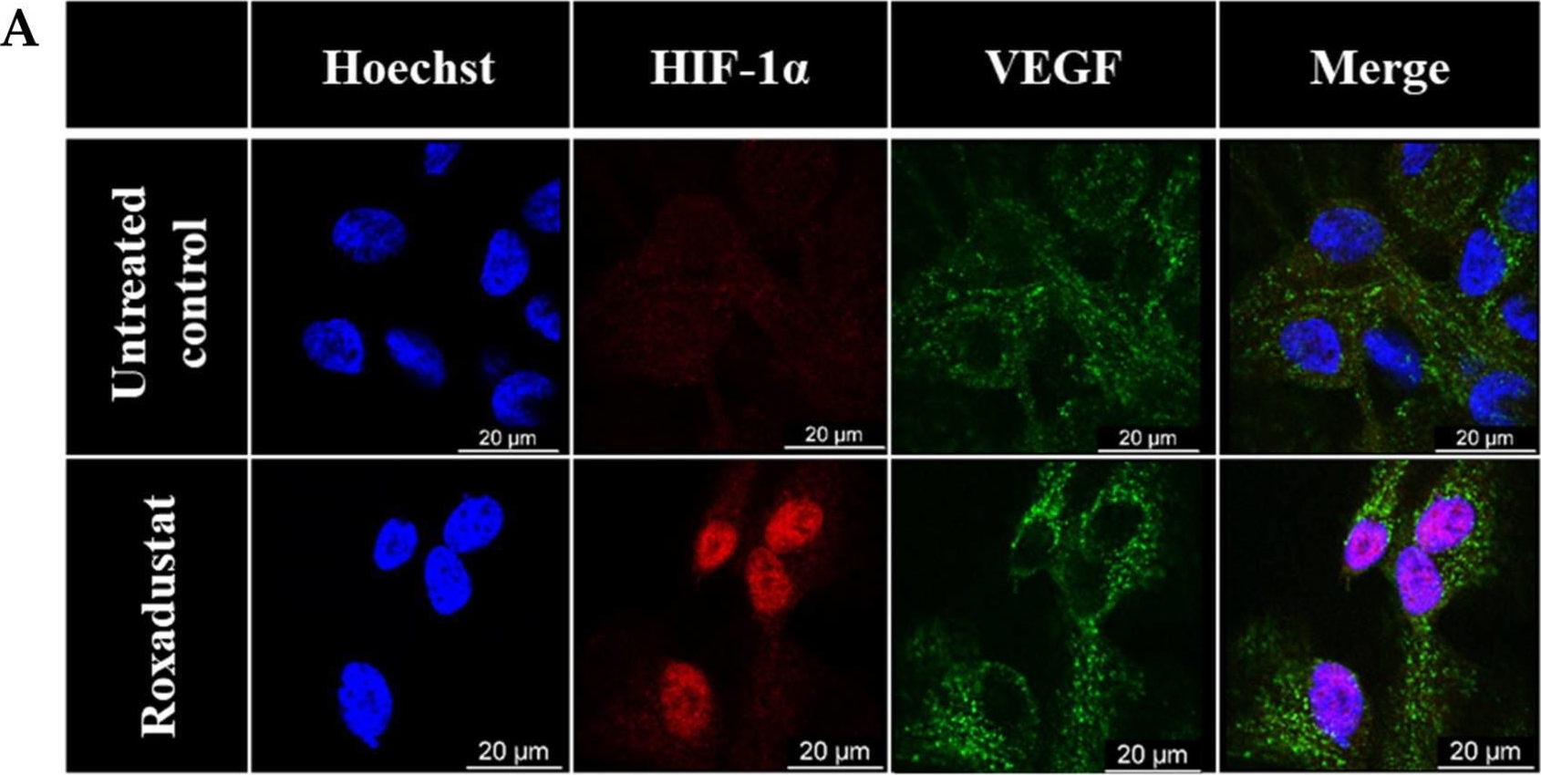 Fig.2.A showing Immunocytochemistry-immunofluorescence in a Homo sapiens (Human) sample from the publication: Prolyl Hydroxylase Inhibitor-Mediated HIF Activation Drives Transcriptional Reprogramming in Retinal Pigment Epithelium: Relevance to Chronic Kidney Disease.