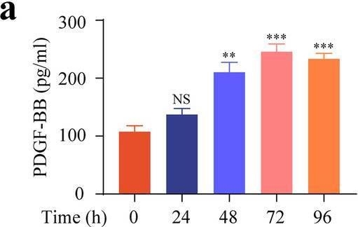 Fig.4.A showing Enzyme-linked immunosorbent assay from the publication: Imatinib inhibits pericyte-fibroblast transition and inflammation and promotes axon regeneration by blocking the PDGF-BB/PDGFRβ pathway in spinal cord injury.