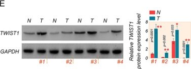 Fig.4.E showing Western Blotting in a Homo sapiens (Human) sample from the publication: FAM64A contributes to ovarian cancer proliferation and metastasis by suppressing TWIST1 ubiquitination and degradation.