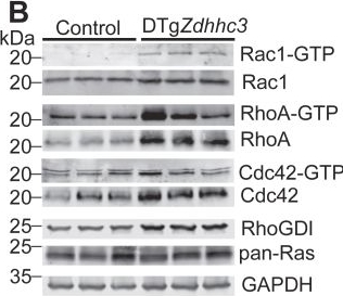 Fig.4.B showing Western Blotting from the publication: Palmitoylation-dependent regulation of cardiomyocyte Rac1 signaling activity and minor effects on cardiac hypertrophy.