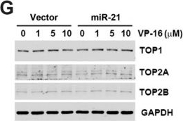 Fig.2.G showing Western Blotting in a Homo sapiens (Human) sample from the publication: In Vitro and In Silico Mechanistic Insights into miR-21-5p-Mediated Topoisomerase Drug Resistance in Human Colorectal Cancer Cells.