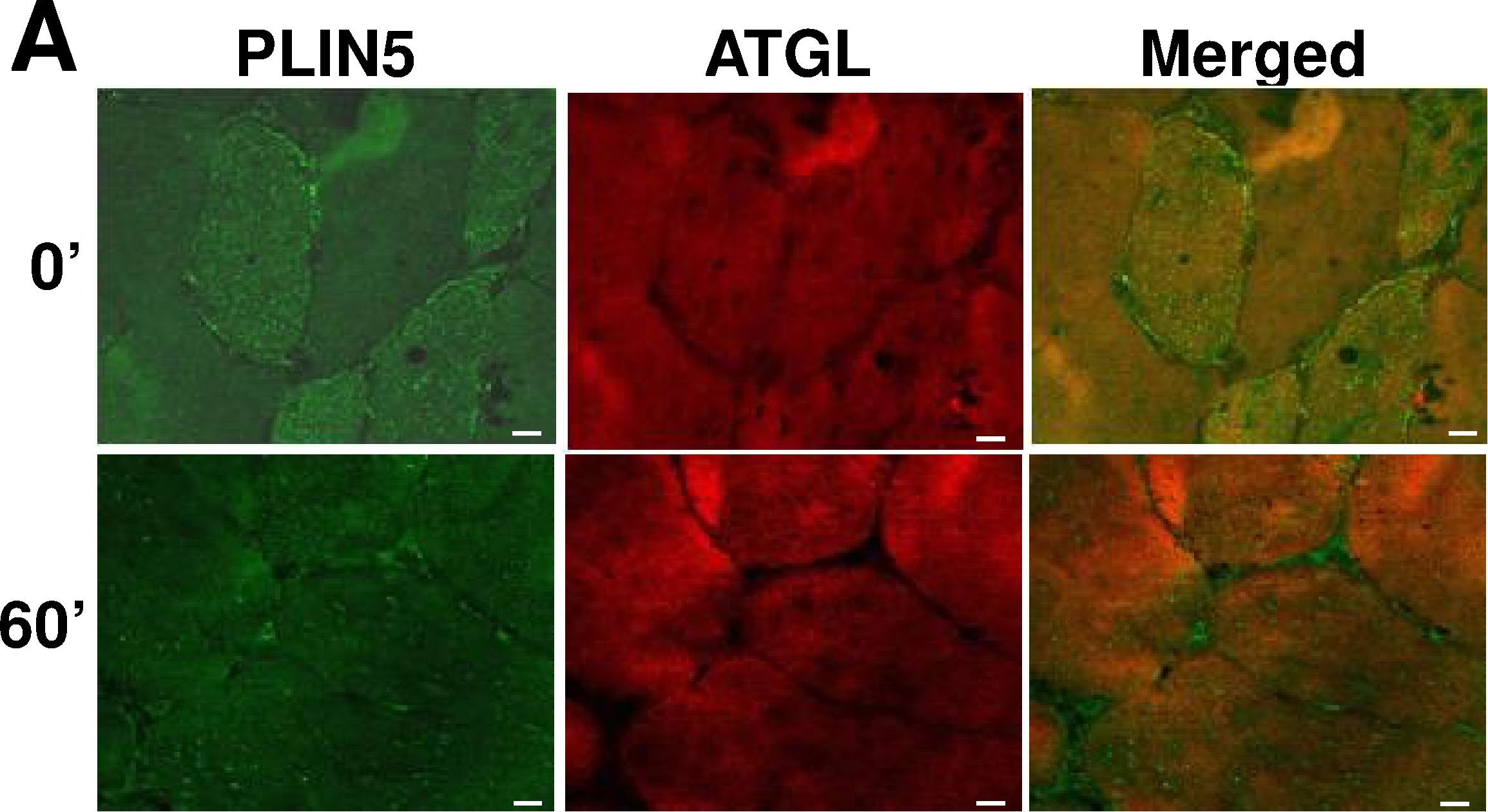 Cellular localization and associations of the major lipolytic proteins in human skeletal muscle at rest and during exercise.