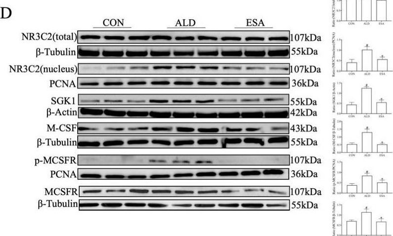 Fig.7.D showing Western Blotting from the publication: Aldosterone-Induced Transformation of Vascular Smooth Muscle Cells into Macrophage-like Cells Participates in Inflammatory Vascular Lesions.