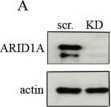 Fig.2.A showing Western Blotting from the publication: Targeting Mitochondrial Metabolism in Clear Cell Carcinoma of the Ovaries.