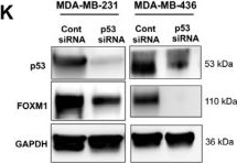Fig.1.K showing Western Blotting in a Homo sapiens (Human) sample from the publication: Targeting p53-Driven FOXM1 Suppresses Tumor Growth and Synergistically Sensitizes to Chemotherapy in Triple-Negative Breast Cancer Models.