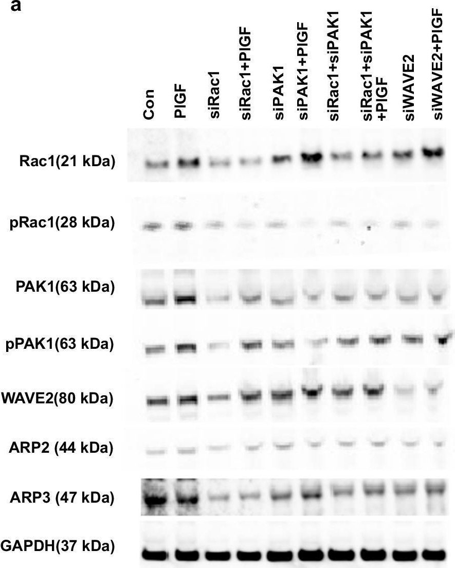 Fig.4.A showing Western Blotting in a Homo sapiens (Human) sample from the publication: Excessive endometrial PlGF- Rac1 signalling underlies endometrial cell stiffness linked to pre-eclampsia.