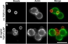 Fig.5.A showing Immunocytochemistry-immunofluorescence in a Homo sapiens (Human) sample from the publication: Selective targeting of transforming growth factor-beta1 into TCR/CD28 signalling plasma membrane domains silences T cell activation.