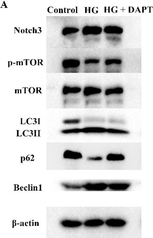 Fig.6.A showing Western Blotting from the publication: Notch3-Mediated mTOR Signaling Pathway Is Involved in High Glucose-Induced Autophagy in Bovine Kidney Epithelial Cells.
