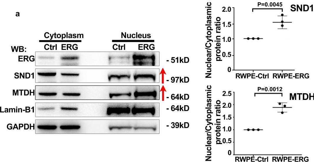 Fig.5.A showing Western Blotting from the publication: SND1 binds to ERG and promotes tumor growth in genetic mouse models of prostate cancer.