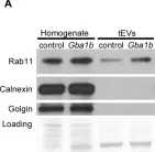 Fig.7.A showing Western Blotting from the publication: Glucocerebrosidase deficiency promotes protein aggregation through dysregulation of extracellular vesicles.