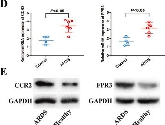 Fig.4.D showing Western Blotting in a Homo sapiens (Human) sample from the publication: Identification and validation of candidate genes dysregulated in alveolar macrophages of acute respiratory distress syndrome.